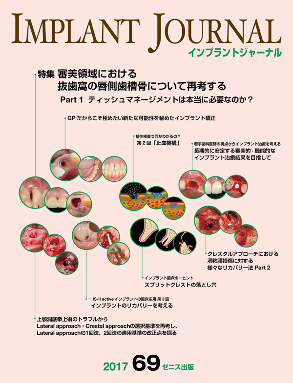 歯界展望 123巻6号 欠損歯列におけるインプラント治療と矯正治療の組み立て 歯界展望別冊 エンド処置歯の支台築造・歯冠修復 歯内療法と補綴