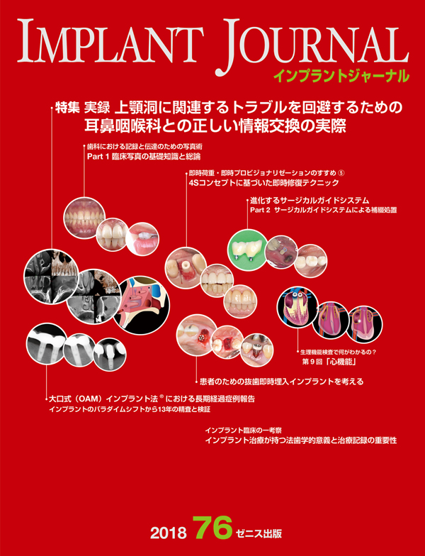 ゆき　インプラントジャーナル シエン社 | インプラントジャーナル／94号