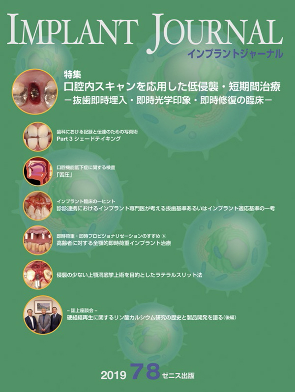 シエン社 | インプラントジャーナル／91号