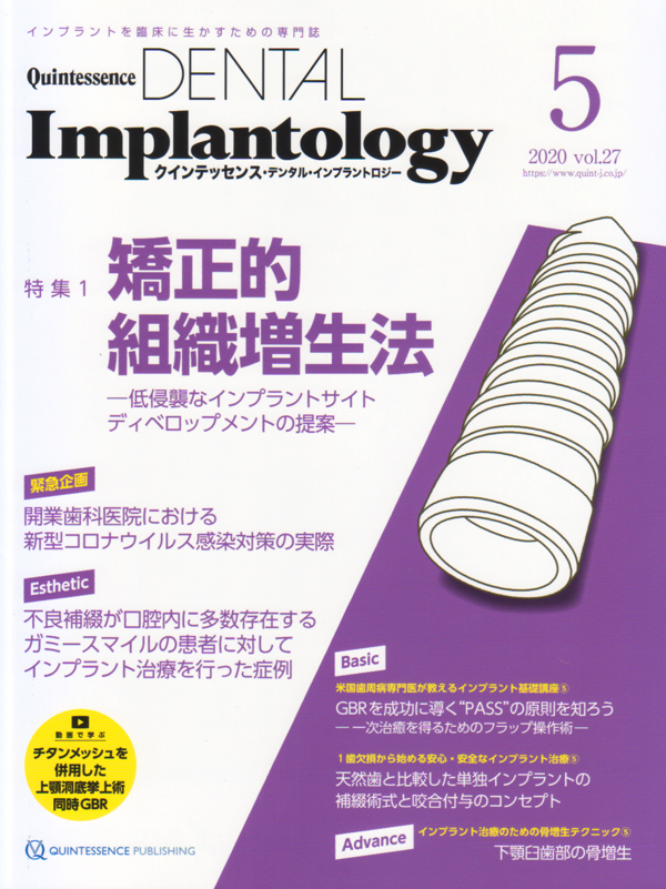 エビデンス・ベースト・インプラントロジー 正しい臨床決断をするためのエビデンス・ベースト・インプラント