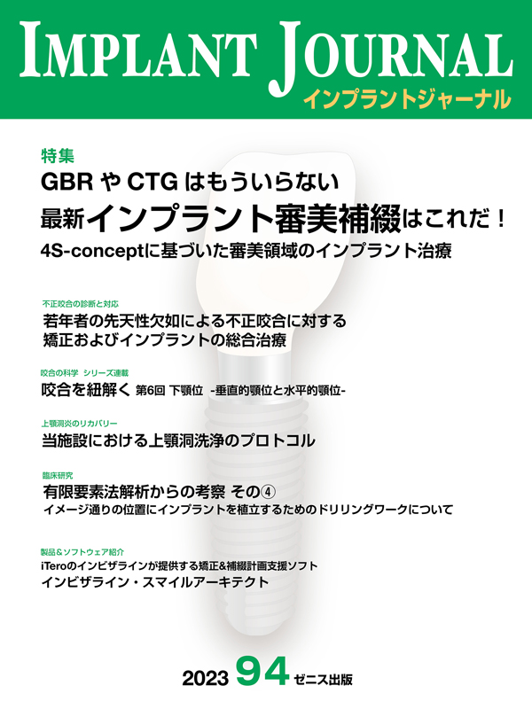 ゆき　インプラントジャーナル シエン社 | インプラントジャーナル／94号