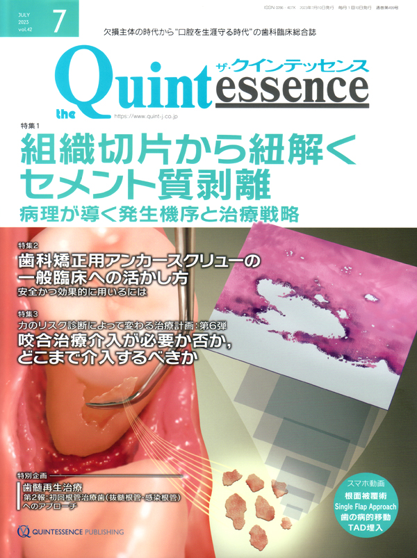 総義歯の真髄　クインテッセンス 総義歯の真髄 - クインテッセンス出版