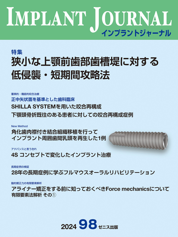 インプラント治療の根拠とその実践 シエン社 | エビデンスに基づいたインプラント治療・骨造成