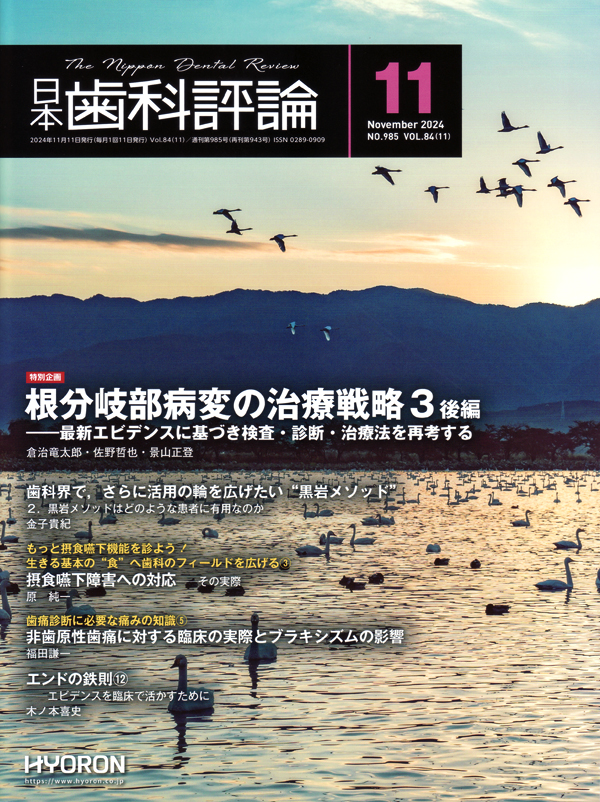 失活歯こリコンストラクション 失活歯こリコンストラクション トライオートZX 歯科