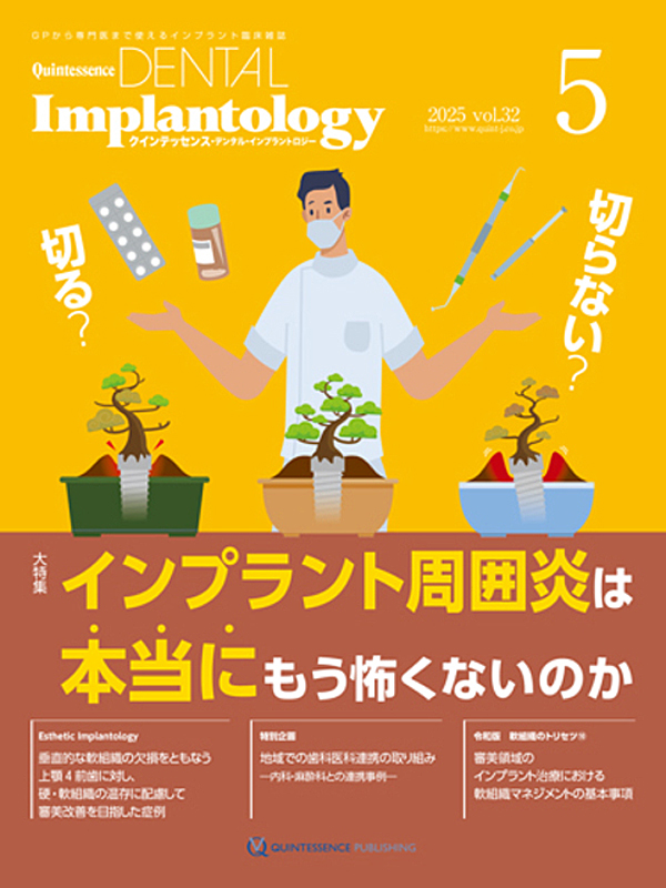 【裁断済み】インプラント周囲炎ゼロコンセプト シエン社 | インプラント周囲炎ゼロコンセプト