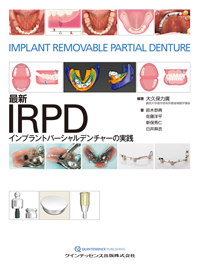 シエン社 | 最新IRPD