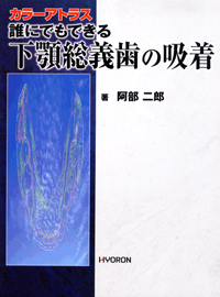 シエン社 | <カラーアトラス>誰にでもできる下顎総義歯の吸着