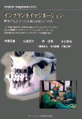 インプラントイマジネーション（DVD版） 映像で見るさらなる適応症拡大への技 シエン社 | インプラントイマジネーション