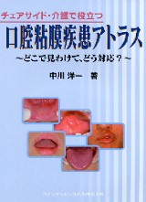 チェアサイド・介護で役立つ口腔粘膜疾患アトラス どこで見わけて、どう対応？/クインテッセンス出版/中川洋一（口腔外科学）（大型本） 新版 チェアサイド・介護で役立つ 口腔粘膜疾患アトラス | 中川