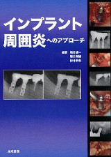 シエン社 | インプラント周囲炎へのアプローチ
