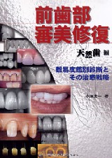 シエン社 | 前歯部審美修復 天然歯編