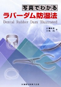シエン社 | 歯内療法