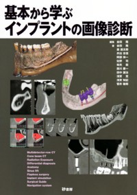 シエン社 | 基本から学ぶインプラントの画像診断