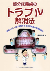 シエン社 | 部分床義歯のトラブル解消法