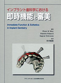 ITI インプラントの理論と実際 - 株式会社 第一歯科出版