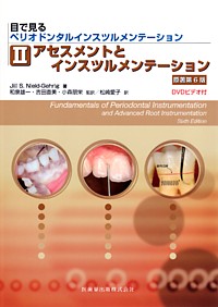 シエン社 | 目で見るペリオドンタルインスツルメンテーション