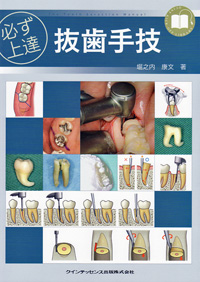 シエン社 | 必ず上達 抜歯手技