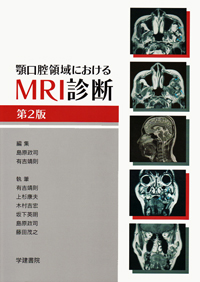 顎・口腔のCT・MRI 顎・口腔のCT・MRI | 酒井 修, 金田 隆 |本 | 通販 | Amazon