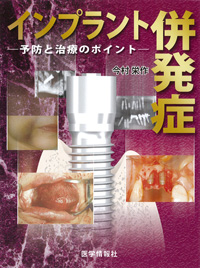 Amazon.co.jp: インプラント併発症: 予防と治療のポイント