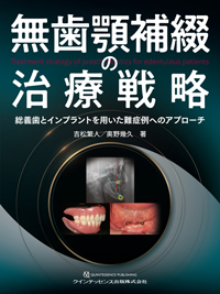 シエン社 | 無歯顎補綴の治療戦略 - 歯科学