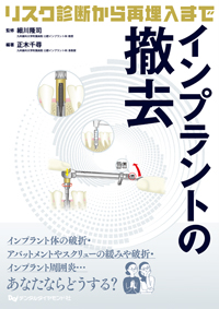 インプラントの撤去 911kit_10.jpg