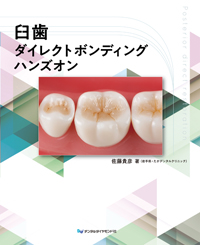 シエン社 | 臼歯ダイレクトボンディング ハンズオン