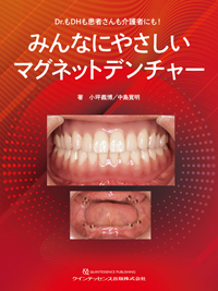 無痛デンチャーの臨床 総義歯 補綴臨床