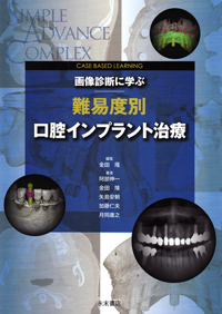 シエン社 | 画像診断に学ぶ難易度別口腔インプラント治療