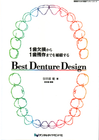 シエン社 | 1歯欠損から1歯残存までを補綴する Best Denture