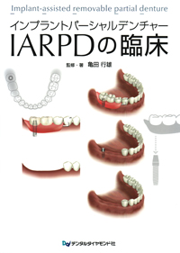 シエン社 | インプラントパーシャルデンチャーIARPDの臨床