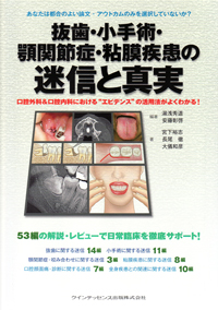シエン社 | 抜歯・小手術・顎関節症・粘膜疾患の迷信と真実