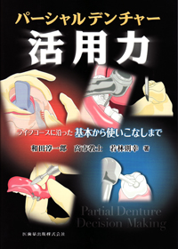 シエン社 | パーシャルデンチャー活用力