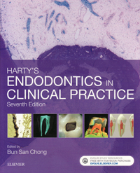 シエン社 | Endodontics