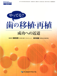 シエン社 | やってる？歯の移植・再植