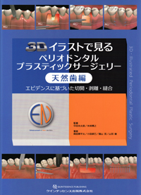シエン社 | エビデンスに基づいたペリオドンタルプラスティック