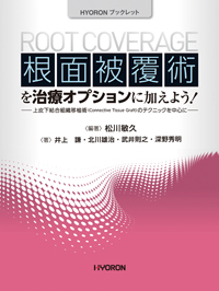 シエン社 | 根面被覆術を治療オプションに加えよう！