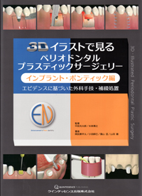 イラストレイテッド ペリオドンタル・マイクロサージェリー 81V0FCBoUbL._UF350,350_QL50_.jpg