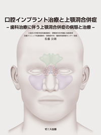 本日のタイムセール - ホットプレート / ホット シエン社 口腔インプラント治療と上顎洞合併症 | 健康・医学