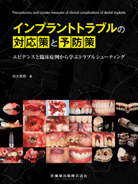 Amazon.com: インプラントトラブルの対応策と予防策
