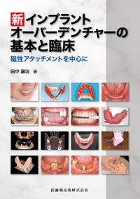 ★裁断済 新 インプラント オーバーデンチャーの基本と臨床 シエン社 | 新インプラントオーバーデンチャーの基本と臨床