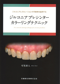 Amazon.co.jp: 月刊「歯科技工」別冊審美歯科治療のための天然歯