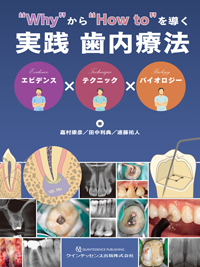 Why”から“How to”を導く実践 歯内療法の購入ならWHITE CROSS