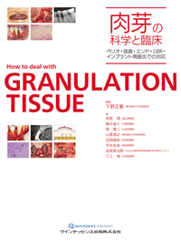 肉芽の科学と臨床 : ぺリオ・抜歯・エンド・GBR・インプラント周囲炎での対応… シエン社 | 肉芽の科学と臨床