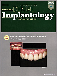 インプラントセラピー シエン社 | クインテッセンス・デンタル・インプラントロジー／18-5