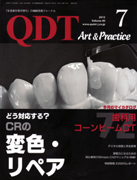 歯太郎ページ むし歯／エックス線診査表（ICDASフォトパネル）・根面むし歯の