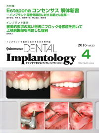 インプラントイマジネーション シエン社 | 検索結果