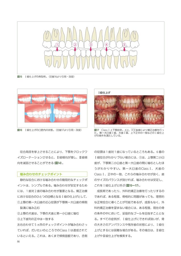 オルソインプラントセラピー
