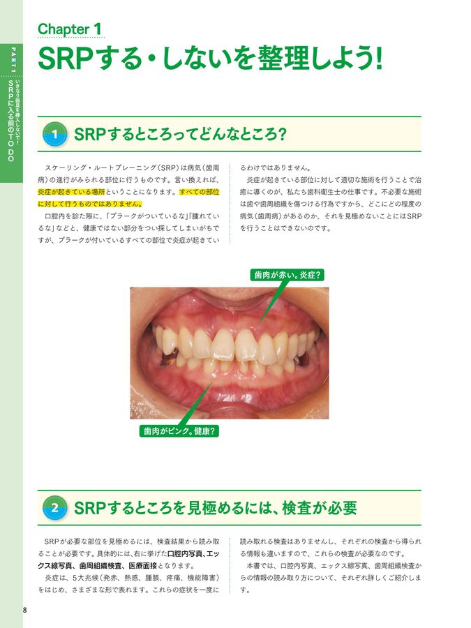 口腔・咽頭疾患,歯牙関連疾患を診る 新版 チェアサイド・介護で役立つ 口腔粘膜疾患アトラス | 中川