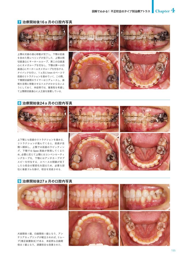 裁断済み　GPのための矯正歯科臨床ガイドブック