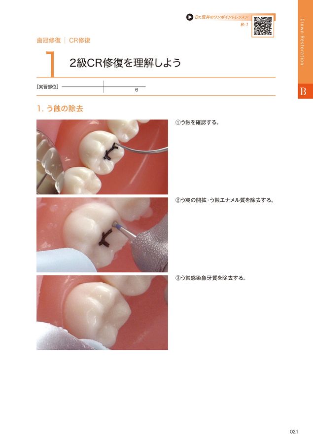 GP臨床トレーニングBOOK &amp; MOVIE (2) GP臨床トレーニング BOOK & MOVIE（2）歯冠修復 編| 歯科総合